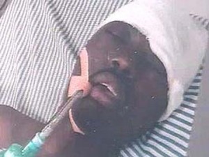 Yannick Nihangaza has remained on life support (ventilator) system ever since the assault on him by some youths in Jalandhar. (File photo)